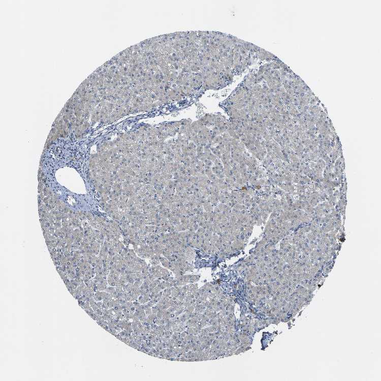 Tissue expression of LDLR Staining in liver The Human Protein Atlas