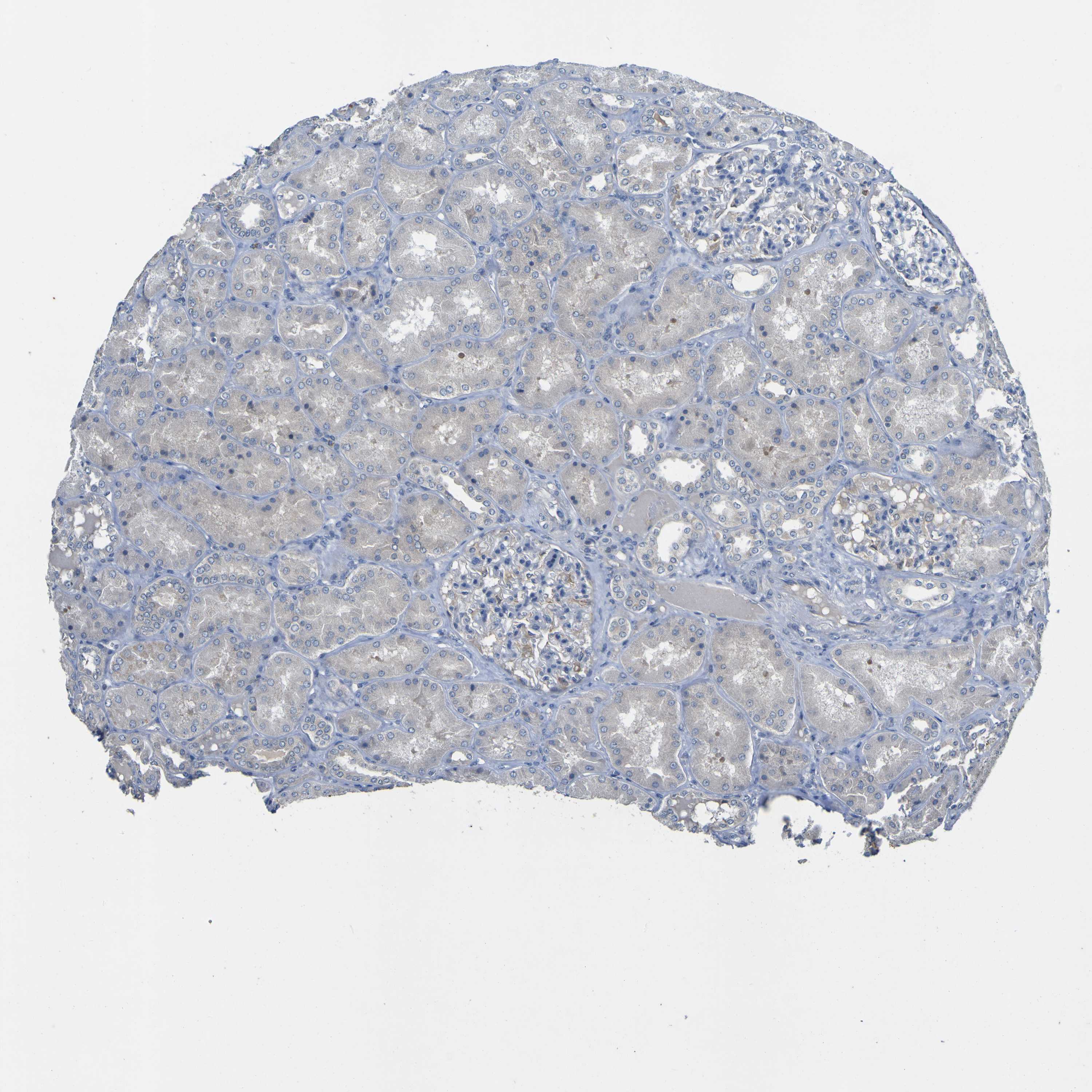 Tissue expression of LDLR Staining in kidney The Human Protein Atlas