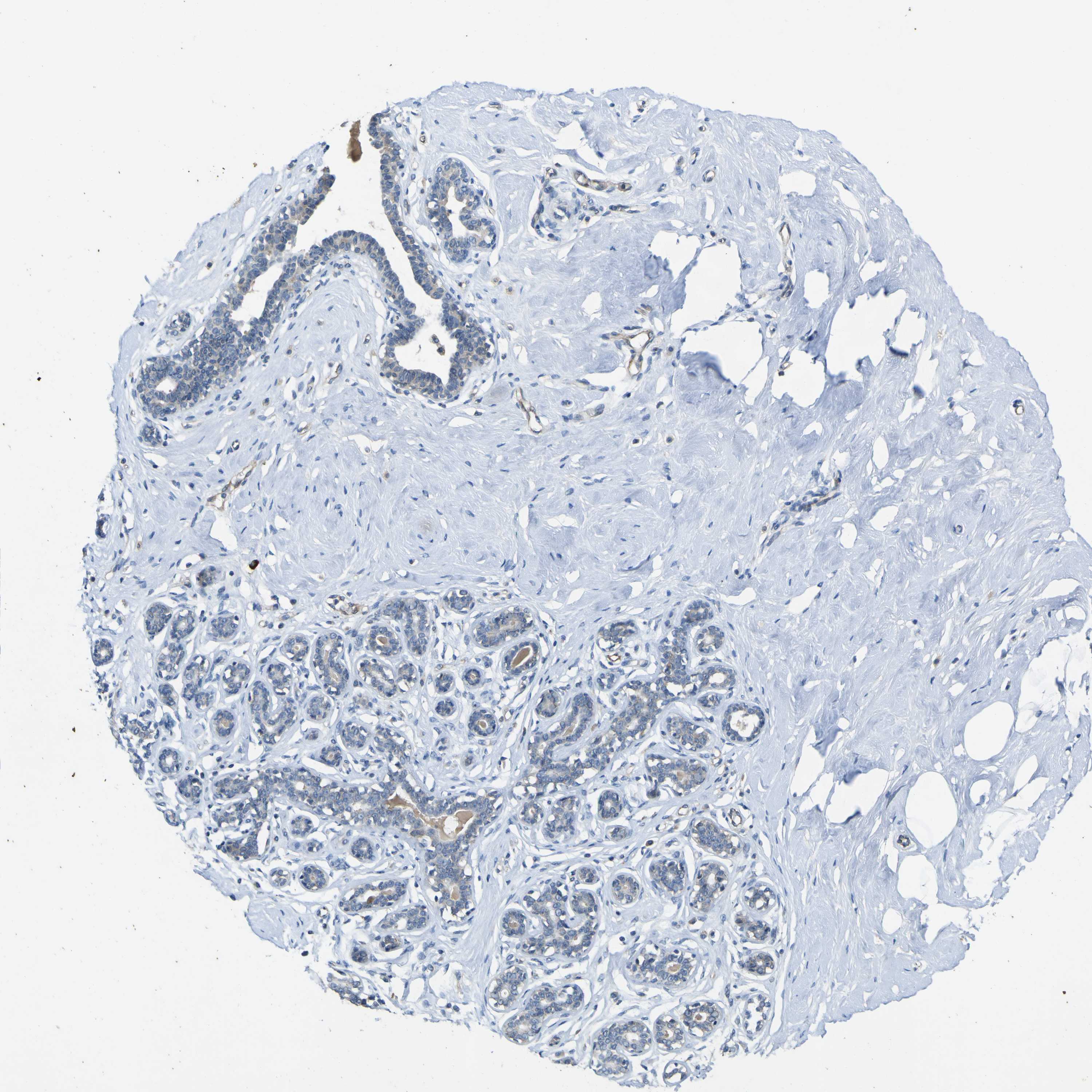 Tissue expression of LDLR Staining in breast The Human Protein Atlas