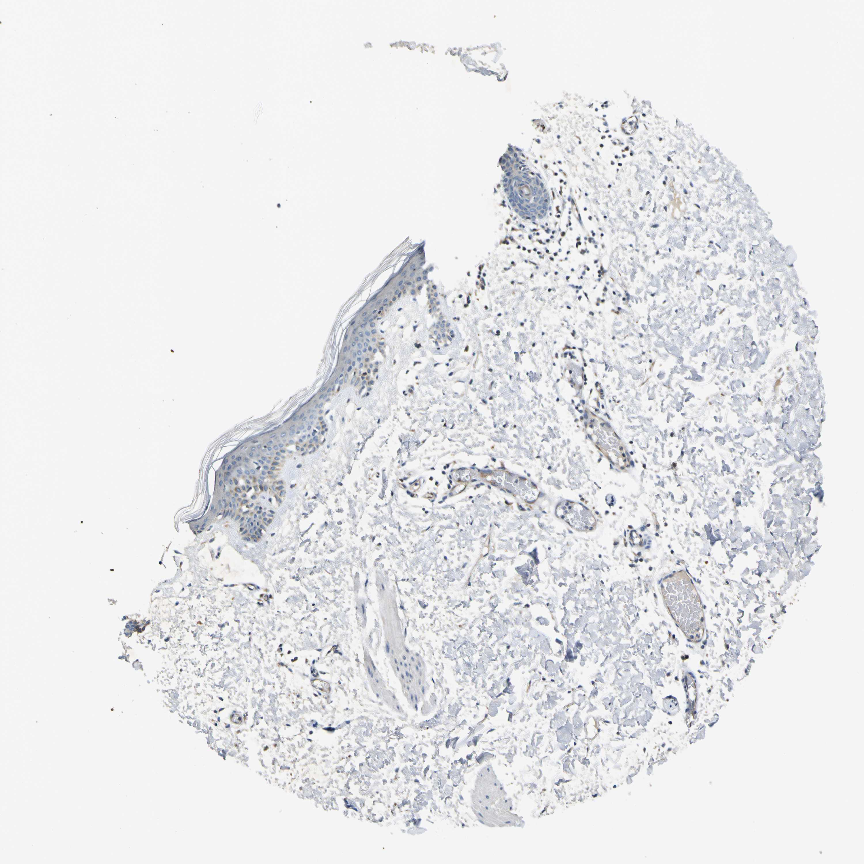 Tissue expression of LDLR Staining in skin The Human Protein Atlas
