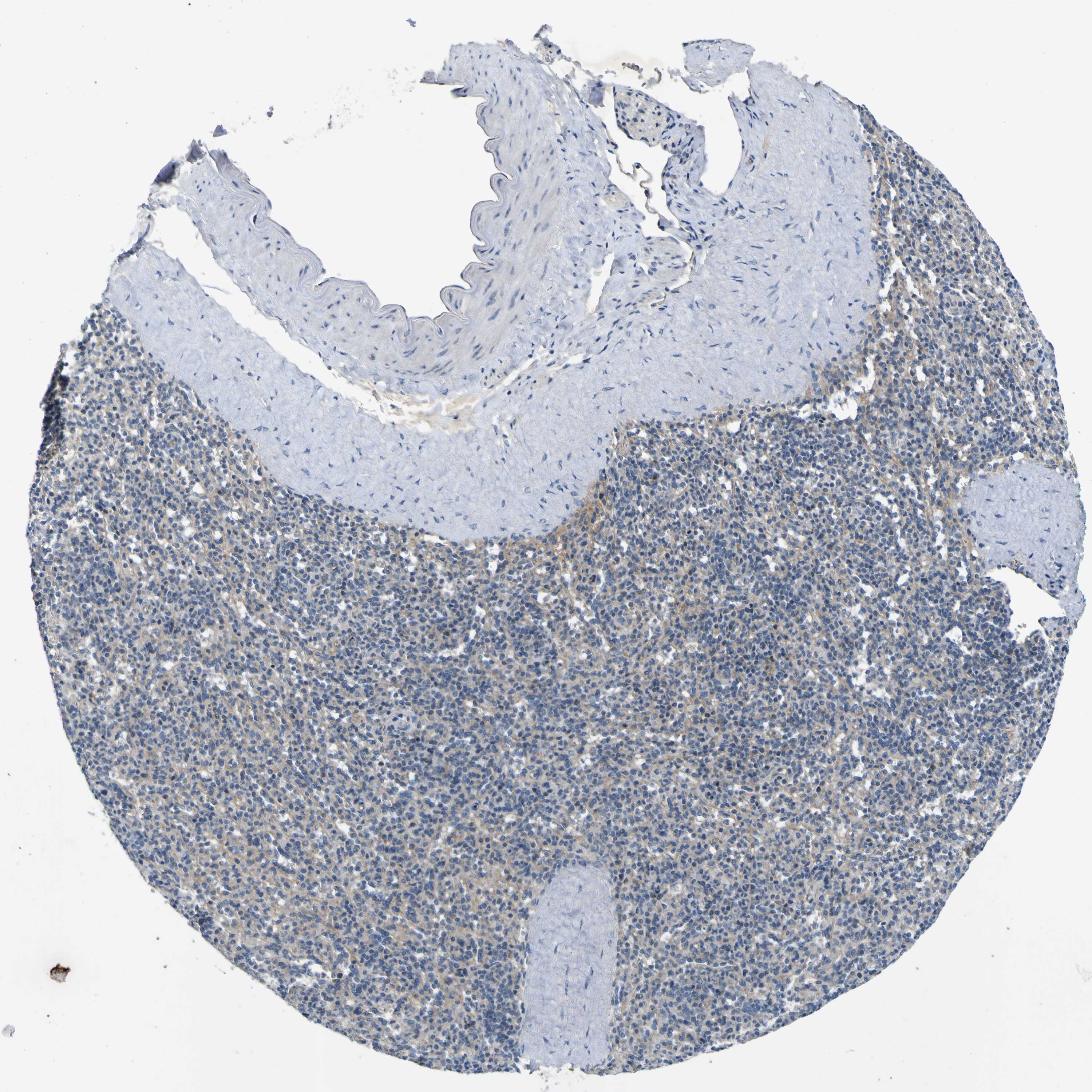 Tissue expression of LDLR Staining in spleen The Human Protein Atlas
