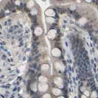 HPA IHC Colon — GPR158