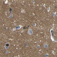 HPA IHC Cerebral cortex — GPR158