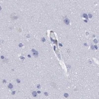 HPA IHC Cerebral cortex — KRT13