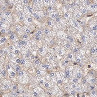 HPA IHC Liver — STX4