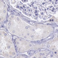 HPA IHC Kidney — MYH4