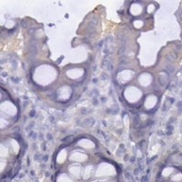 HPA IHC Colon — MYH4