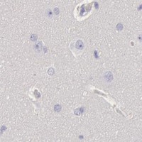 HPA IHC Cerebral cortex — MYH4