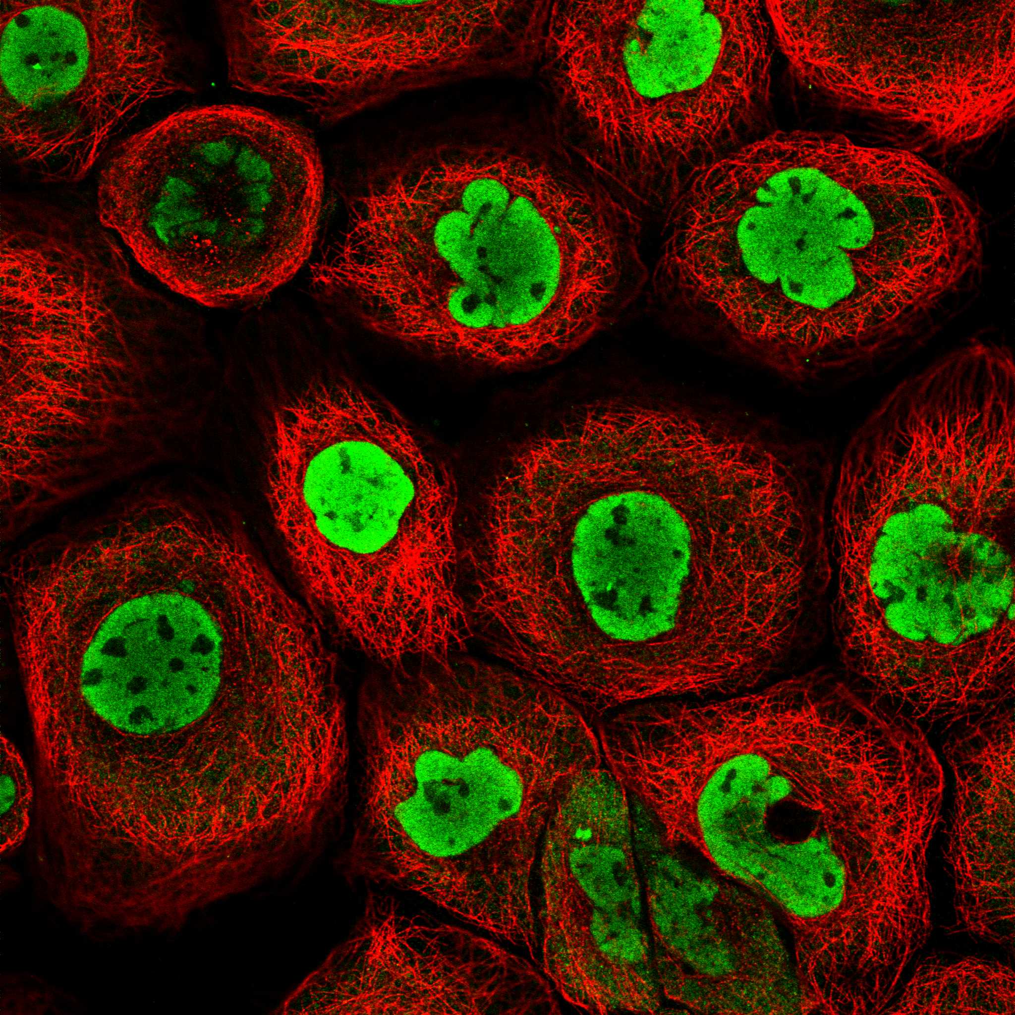 Subcellular PTBP1 The Human Protein Atlas