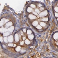 HPA IHC Colon — MYO5A