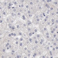 HPA IHC Liver — KRT16