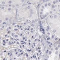 HPA IHC Kidney — KRT16