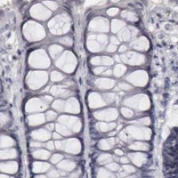 HPA IHC Colon — KRT16