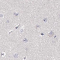 HPA IHC Cerebral cortex — KRT16