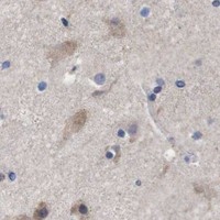 HPA IHC Cerebral cortex — OPN3