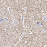 HPA IHC Cerebral cortex — CDH13