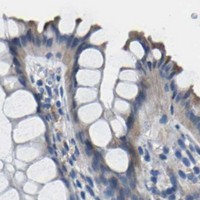HPA IHC Colon — ACKR2