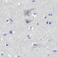 HPA IHC Cerebral cortex — ACKR2