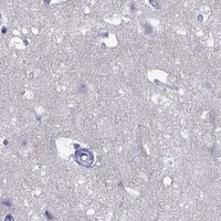 HPA IHC Cerebral cortex — MGP