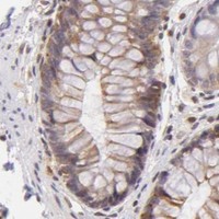 HPA IHC Colon — IMPDH1