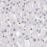 HPA IHC Liver — IMPDH2