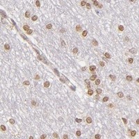 HPA IHC Cerebral cortex — IMPDH1