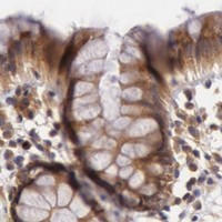 HPA IHC Colon — CHUK