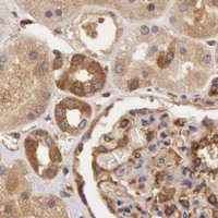 HPA IHC Kidney — CHUK