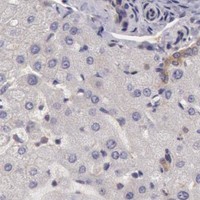 HPA IHC Liver — CHUK