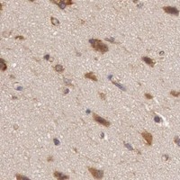 HPA IHC Cerebral cortex — CHUK