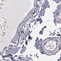 HPA IHC Colon — NEK9