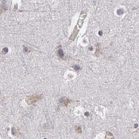 HPA IHC Cerebral cortex — NEK9