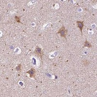 HPA IHC Cerebral cortex — CHRM1