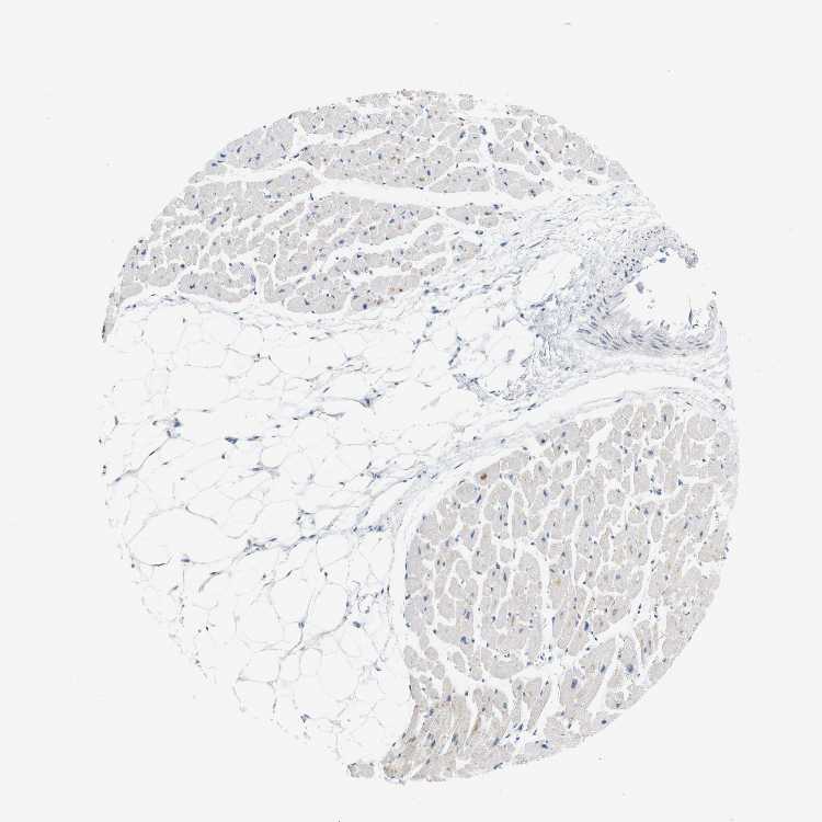 Tissue expression of LRRK2 Staining in heart muscle The Human
