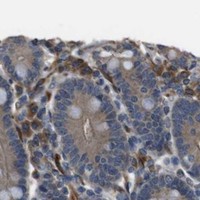 HPA IHC Duodenum — FUT2