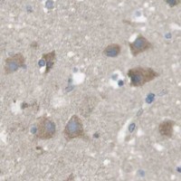 HPA IHC Cerebral cortex — FUT2