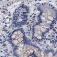 HPA IHC Colon — C5AR1