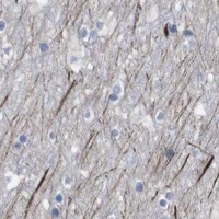 HPA IHC Cerebral cortex — C5AR1