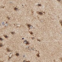 HPA IHC Cerebral cortex — C1QC