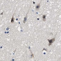 HPA IHC Cerebral cortex — ALDH3A2
