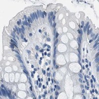 HPA IHC Colon — GJA3
