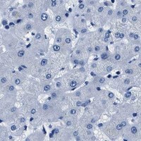 HPA IHC Liver — GJA3