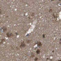HPA IHC Cerebral cortex — SSR3