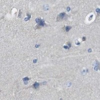 HPA IHC Cerebral cortex — SLC6A6