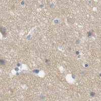 HPA IHC Cerebral cortex — CREB3L2