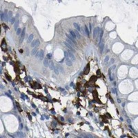 HPA IHC Colon — PTPN1