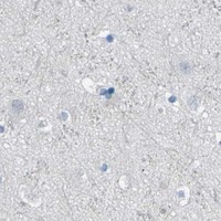 HPA IHC Cerebral cortex — PTPN1