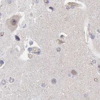 HPA IHC Cerebral cortex — TFRC