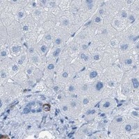 HPA IHC Liver — MYH11