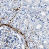 HPA IHC Kidney — MYH11